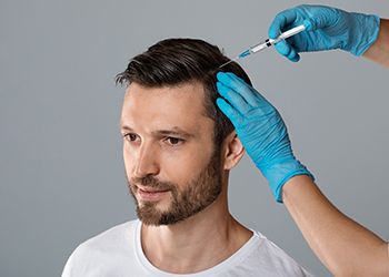 PRP for Hair loss | Platelet Rich Plasma | Hair Loss Treatment